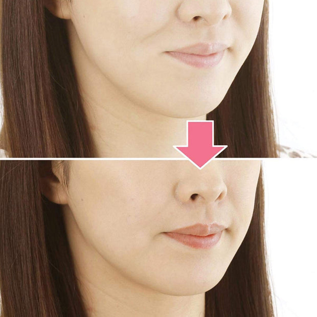 Skin Lifting Masseter Silicone V Face Facial